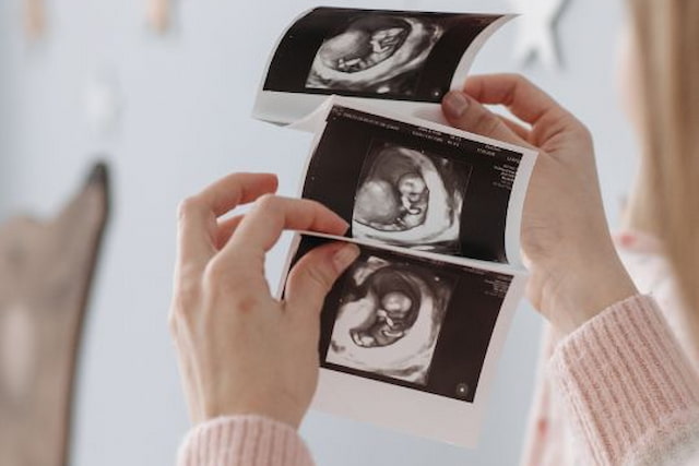 אילו בדיקות מבצעים בהריון